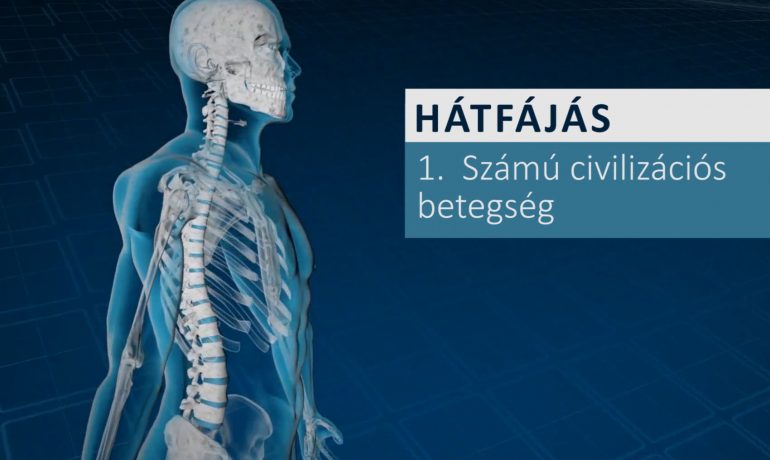 120 MTRS a hátfájás ellen